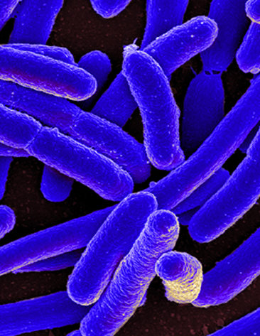 Several purple, cylinder-shaped  E. coli bacteria