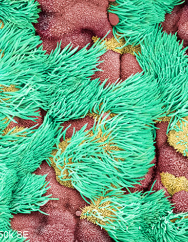 Cilia, looking like clumps of green grass, surround reddish and yellow masses in a mouse's trachea