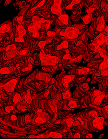 Red splotches representing mitochondrial networks on a black background