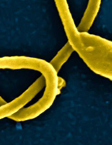Ebola virus particle