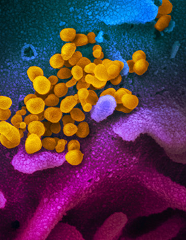 Scientific image featuring small yellow globes bubbling up from purplish pink ribbon
