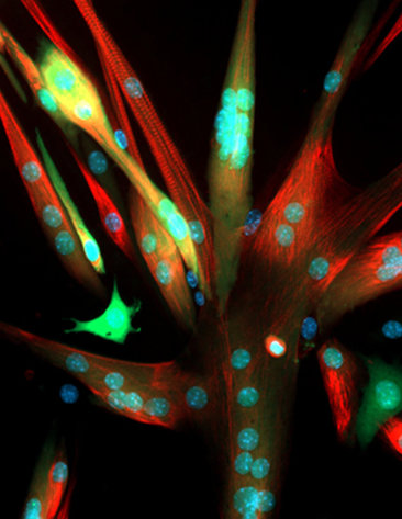 Cells from mouse skeletal muscle stem cells glow green.