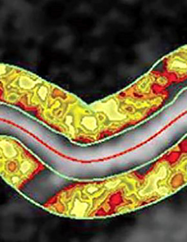 Scientific image of curved yellow tube with a road-like band of gray running horizontally through it. The "road" of gray is bisected by a red line.