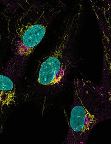 A microscopic image revels La Crosse virus in neural stem cells