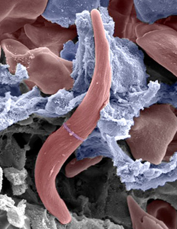 Scanning electron micrograph of a sickled red blood cell (red) inside the circulatory structures of the human spleen, whose function is to filter and remove unhealthy red blood cells, including rigid cells such as sickle-shaped cells. The blue cells indicate the wall of a splenic sinus (small vein where red blood cells are filtered). The gray structures indicate the splenic cords—cellular clusters where the red blood cells are checked by macrophages for the presence of surface alterations or certain antibodies. The image was produced by NHLBI-funded scientist Dr. Pierre Buffet of Inserm-University of Paris, whose research explores the role of the spleen in sickle cell disease. September is Sickle Cell Disease Awareness Month.