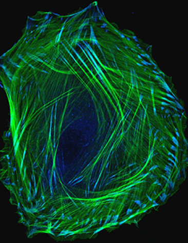 Microscopic image of an Embryonic smooth muscle cell