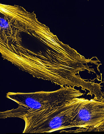 Immunofluorescence image of actin bundles in muscle precursor cells called myoblasts. 