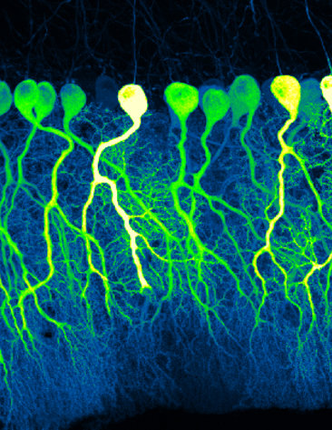 Scientific image of several cells resembling floating balloons with strings attached