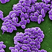 This scanning electron micrograph shows spores from the anthrax vaccine strain of Bacillus anthracis.